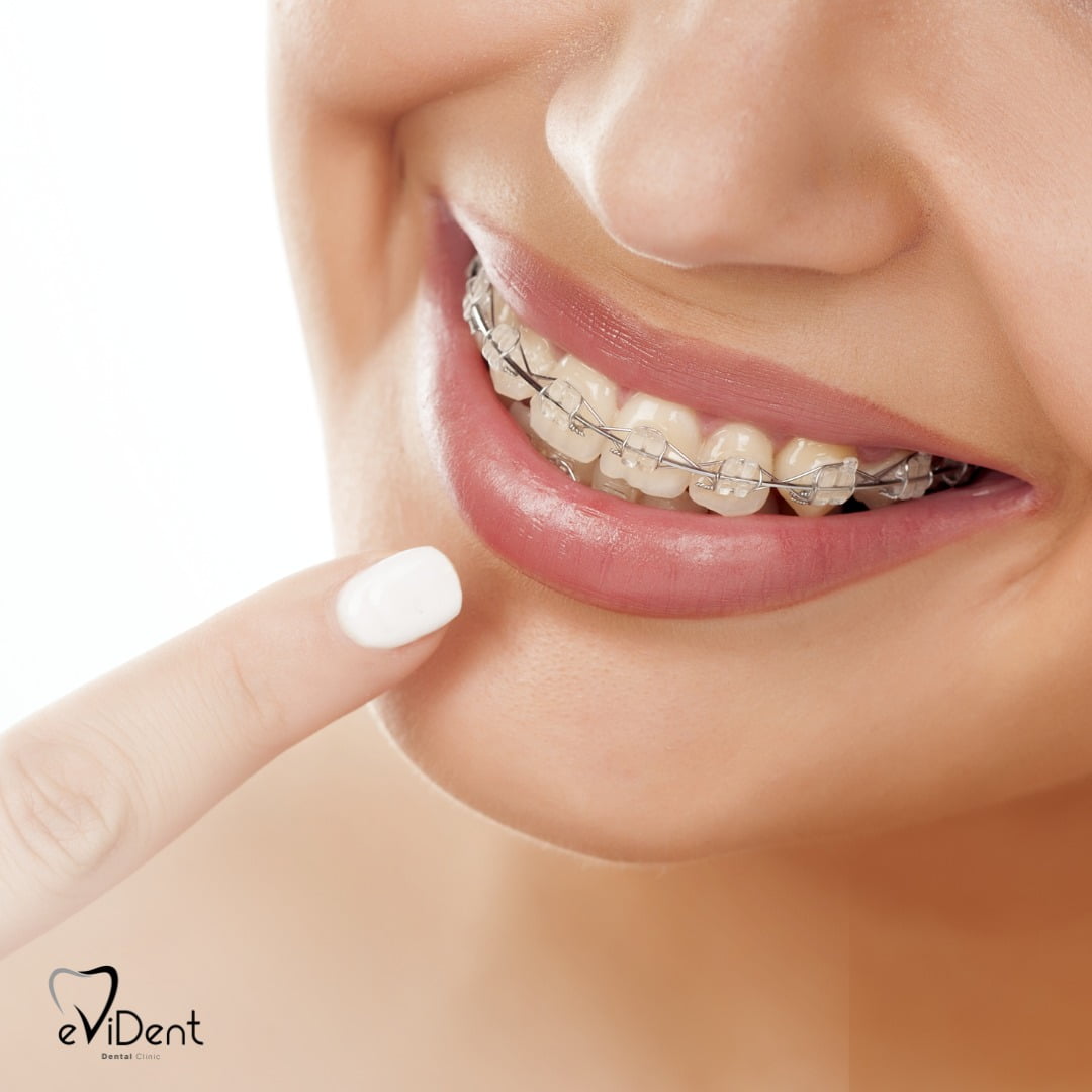 eviDent Dental Clinic - Modern stomatology office in Chisinau with advanced equipment